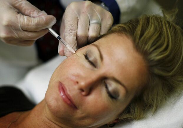 Das Einbringen von Füllstoffen in die Gesichtshaut - eine Injektionsmethode zur Straffung