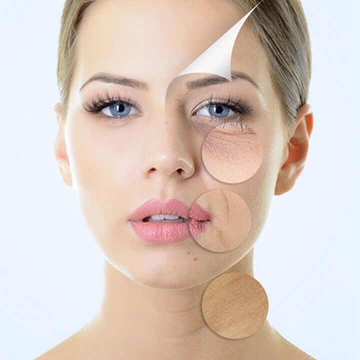 Unreinheiten der Gesichtshaut – Indikationen für Anti-Aging-Behandlungen