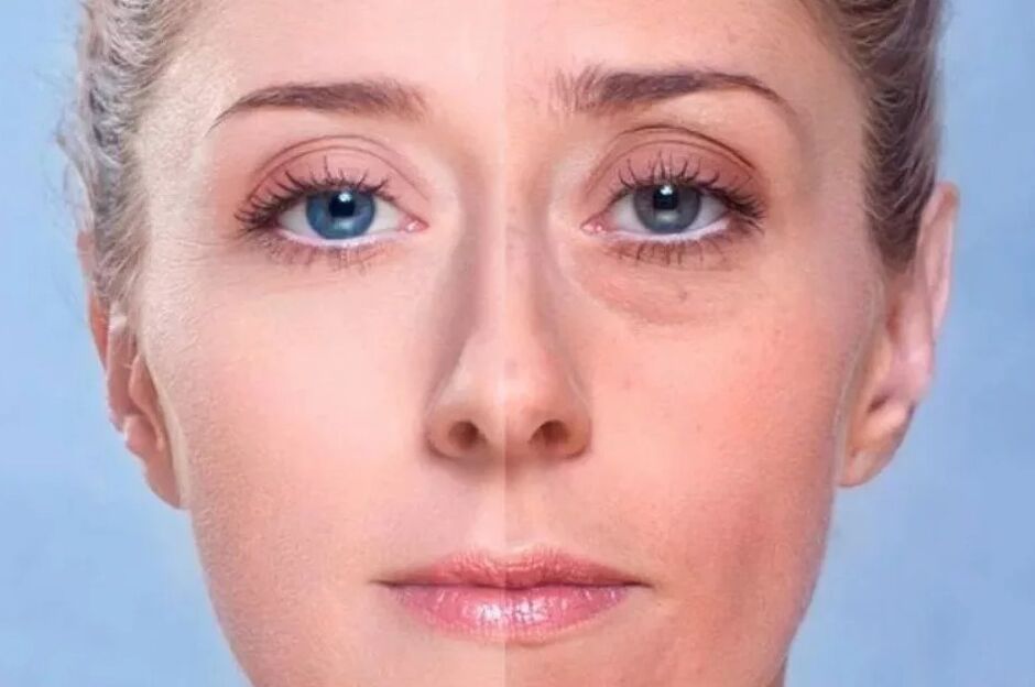 Rücken unter den Augen