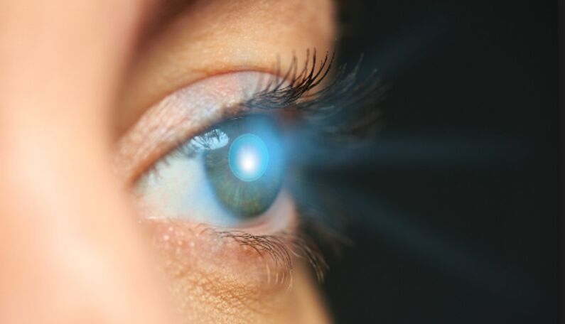 Verjüngung der Haut um die Augen mit einem Laser